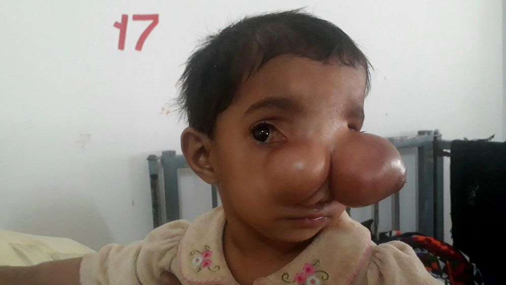 15-mjesečna djevojčica očajnički čeka operaciju koja će joj spasiti život (Foto: Profimedia)