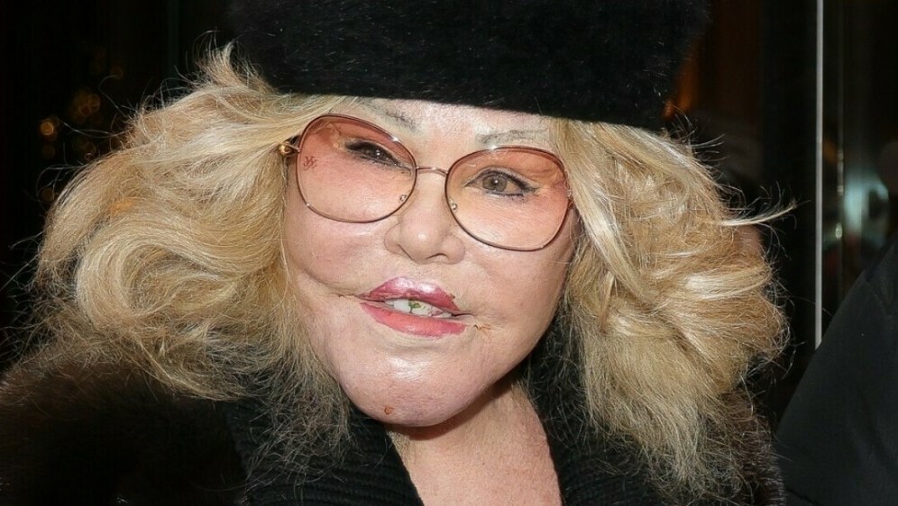 Jocelyn Wildenstein