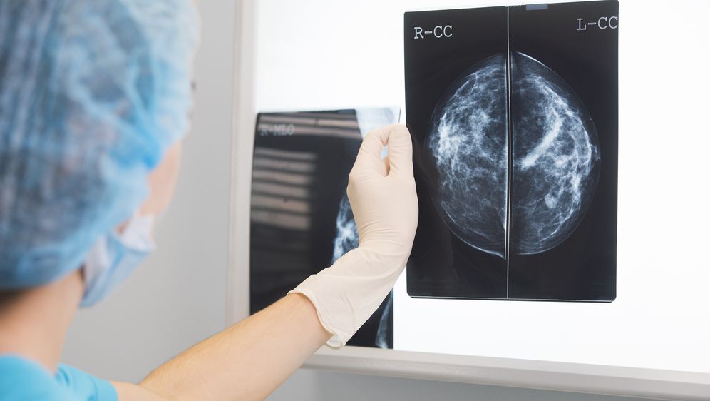 Mamogram