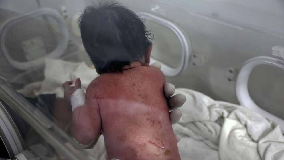 Beba rođena pod ruševinama u Siriji - 1