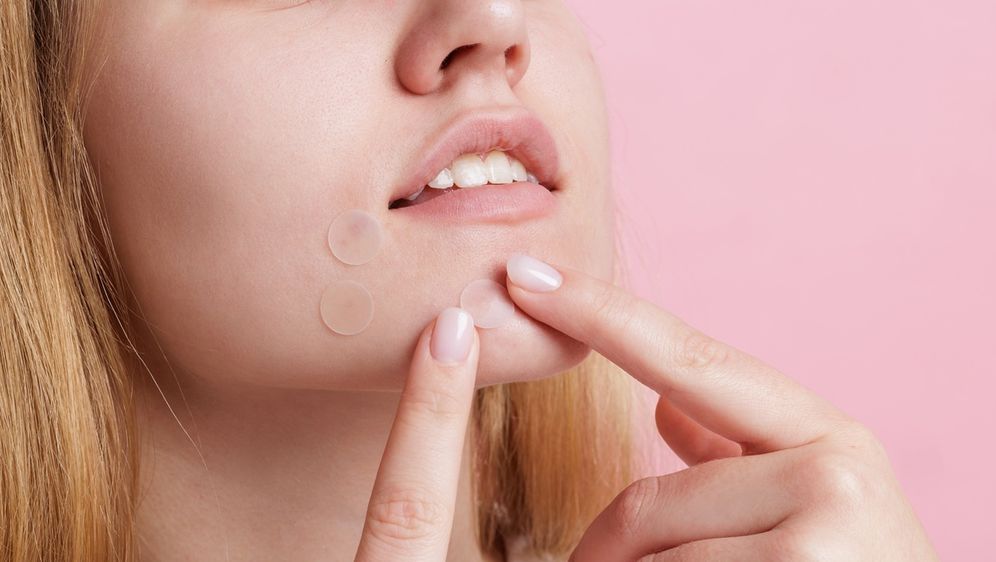 Pimple Patches