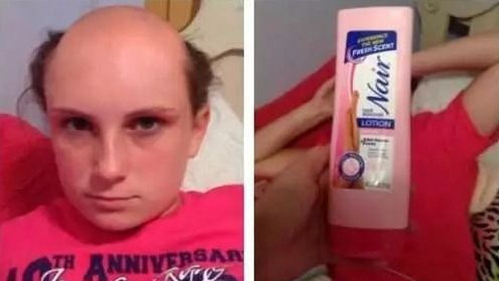 Kriva noga (Foto: buzzfeed.com)