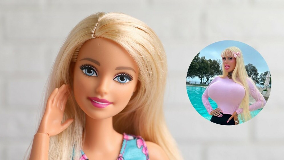 Alicia Amira prije i poslije operacije