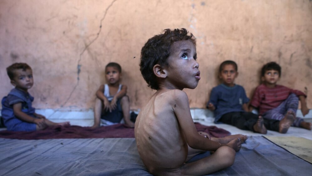 Djeca gladuju u Gazi