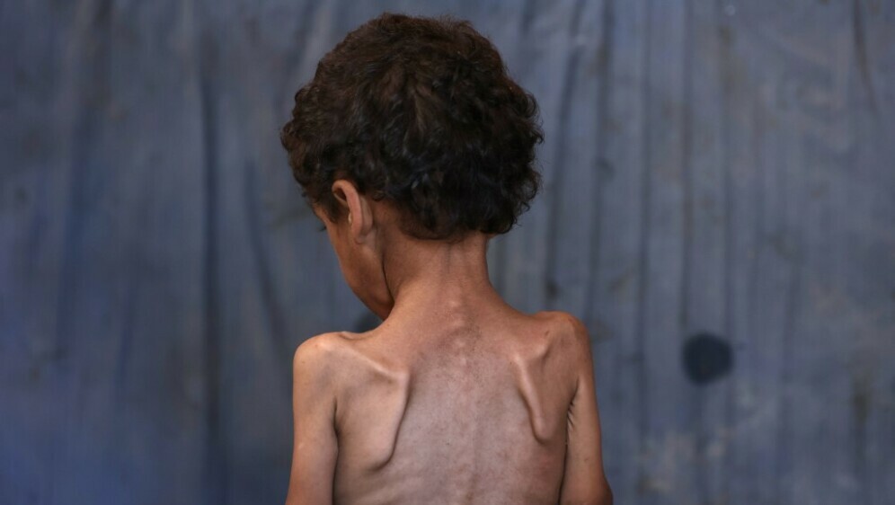 Djeca gladuju u Gazi