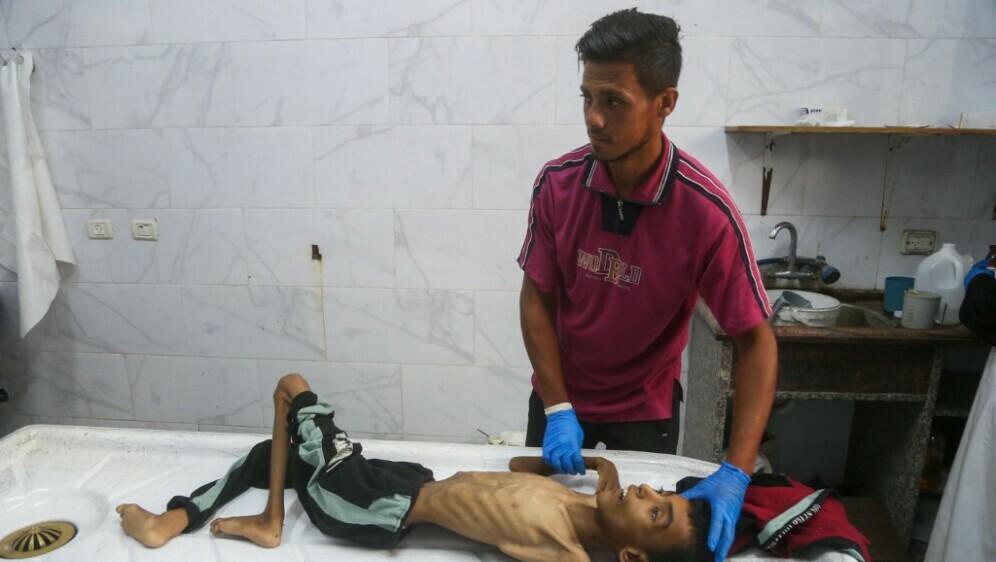 Djeca gladuju u Gazi