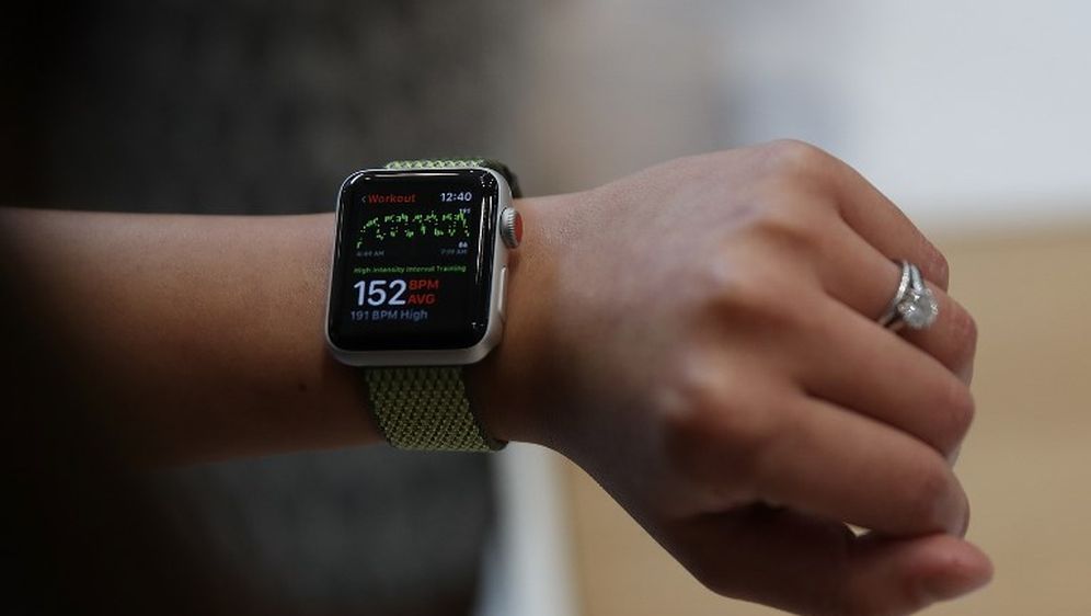 Apple Watch (Foto: AFP)