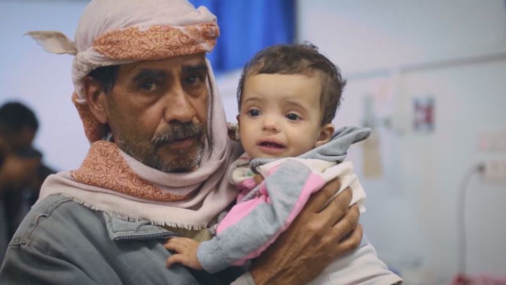 Djeca u Jemenu trebaju pomoć (Foto: Dnevnik.hr) - 1
