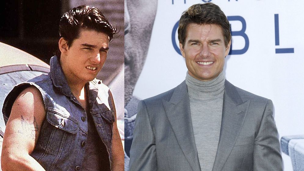 Tom Cruise transformirao je izgled uz pomoću estetske stomatologije