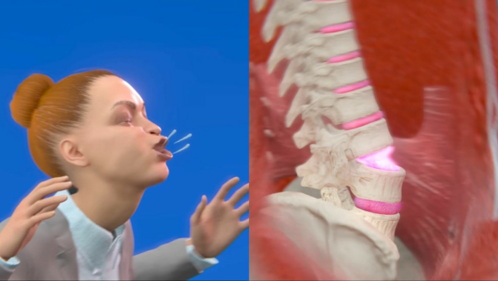 Simulacije ozljede Victorije Kenny koja je kihanje ozlijedila kralježnicu