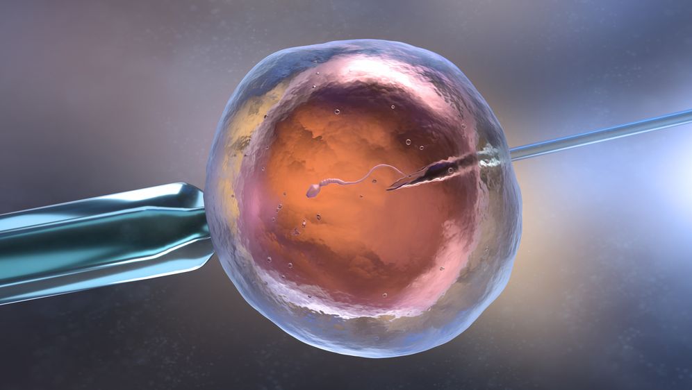 Umjetna oplodnja, IVF, ilustracija