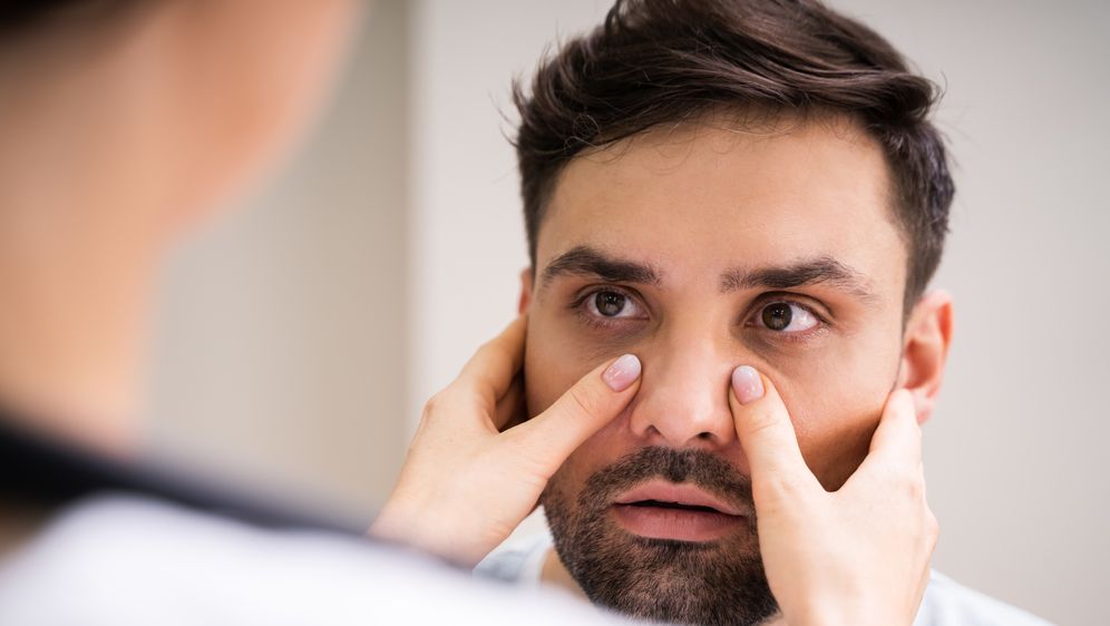 Sinusna infekcija, ilustracija