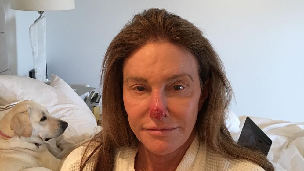 Caitlyn Jenner (FOTO: Instagram)