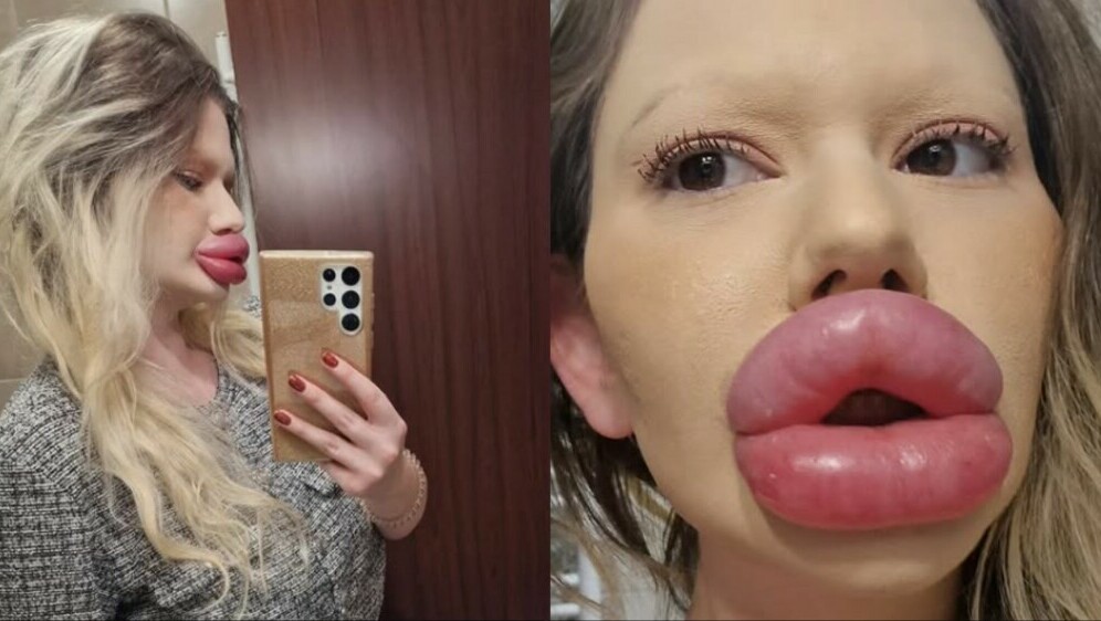 Najveće usne na svijetu Andree Ivanove