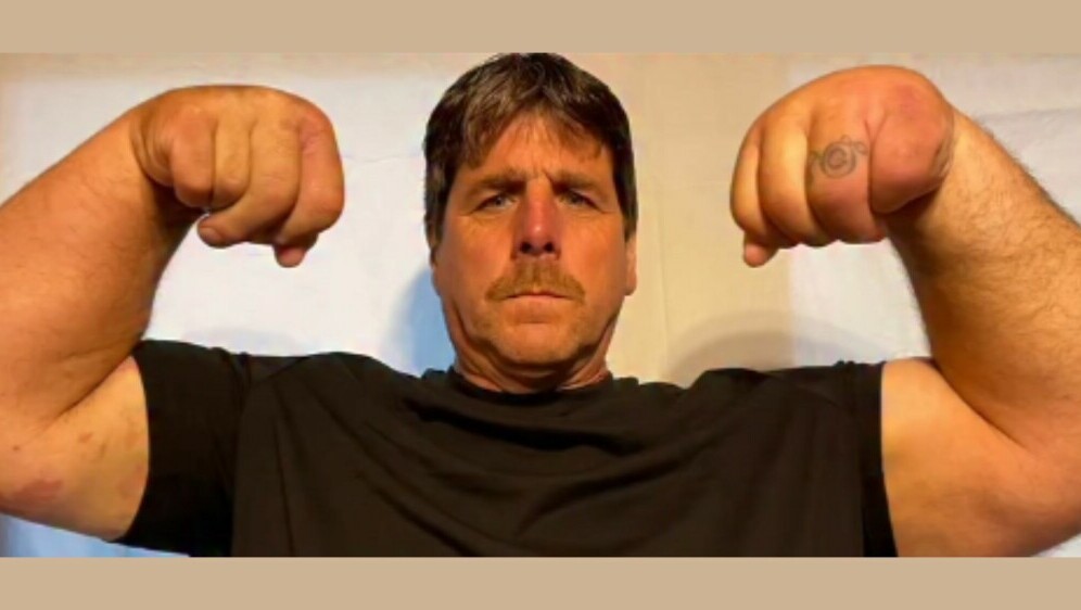 Jeff Dabe i njegove ogromne ruke