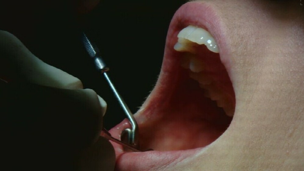 Higijena zubi, ilustracija - 1