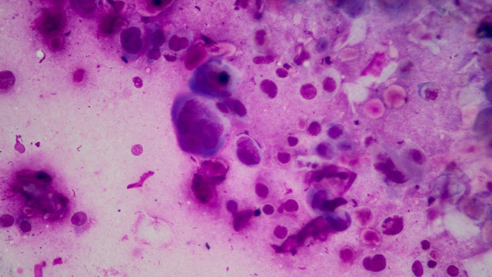 Laboratorijski uzorak herpesa, ilustracija