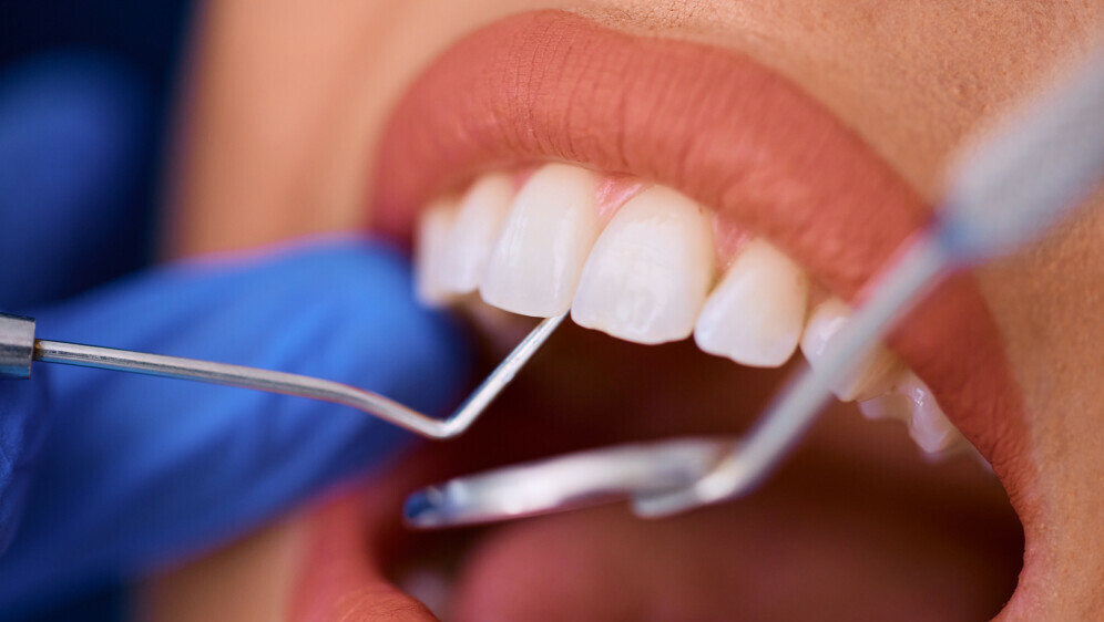 Kako se piše: plomba ili blomba