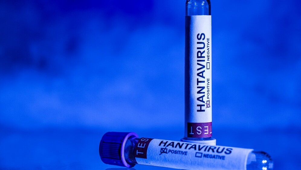 Hantavirus