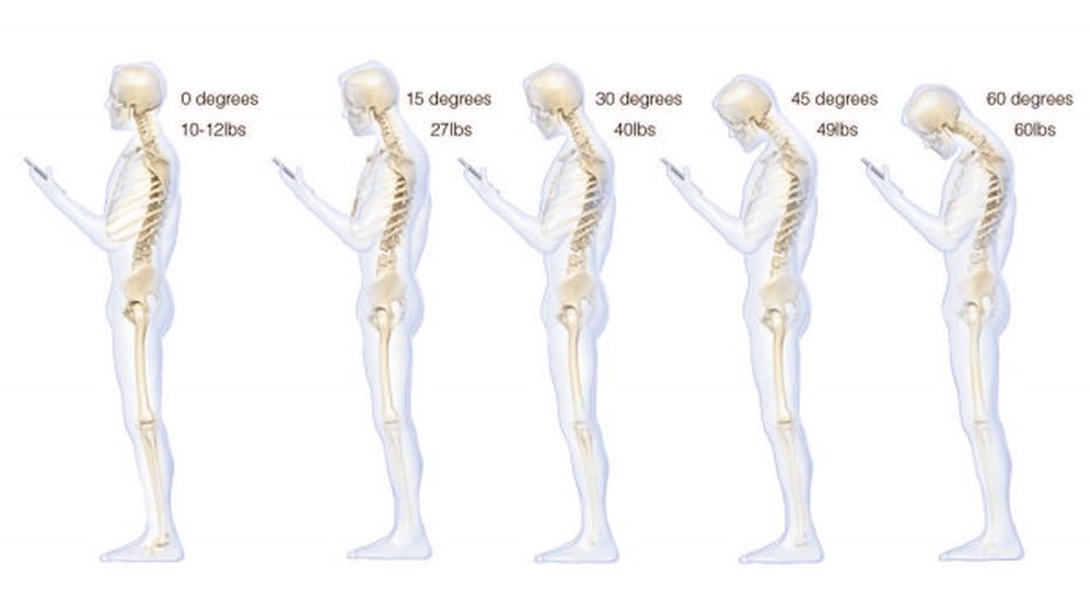 Zbog pametnih telefona ljudi 'uništavaju' leđa!