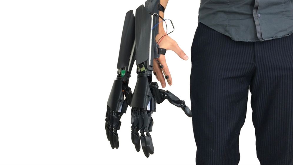 Foto: Youbionic