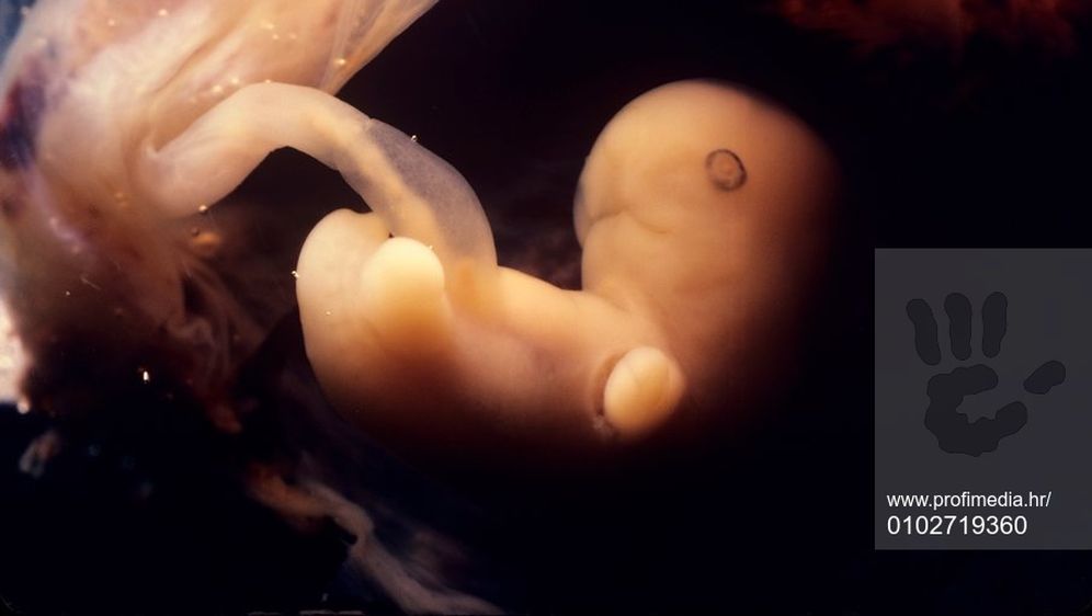 Embrij (Foto: Profimedia)