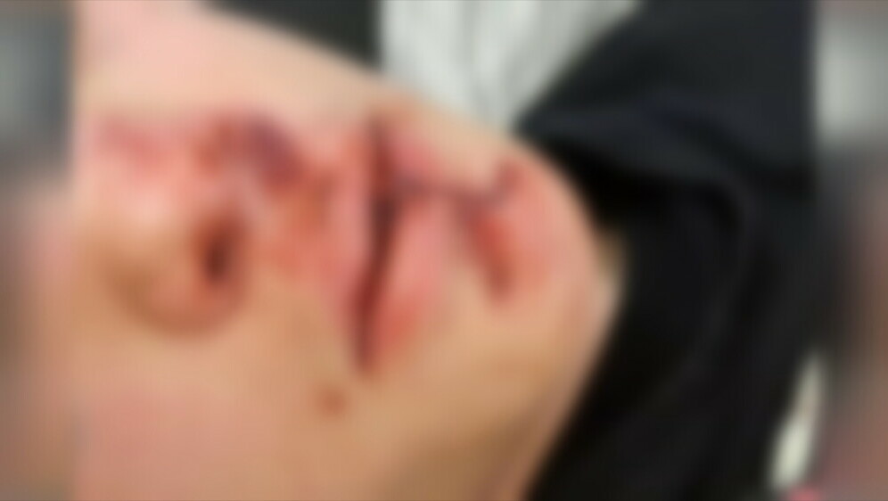 Nasilje; ilustracija - 2