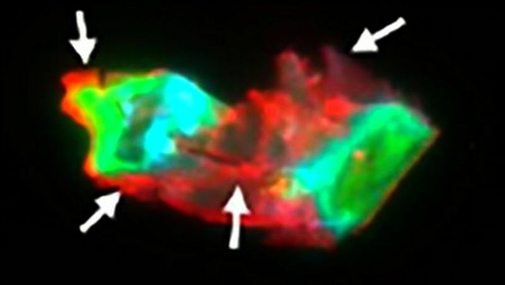 Mikrougrušak u krvi