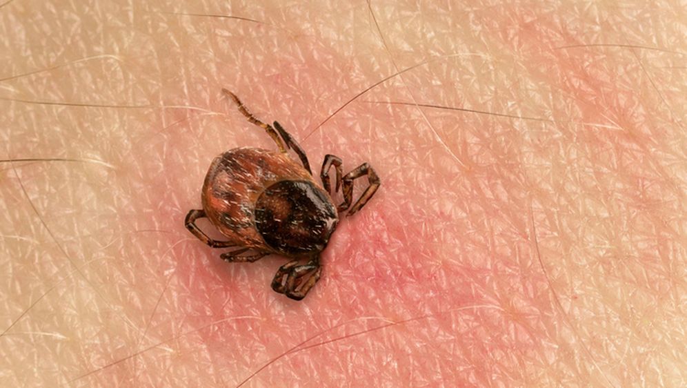 Ubod krpelja (Ilustracija: Getty)