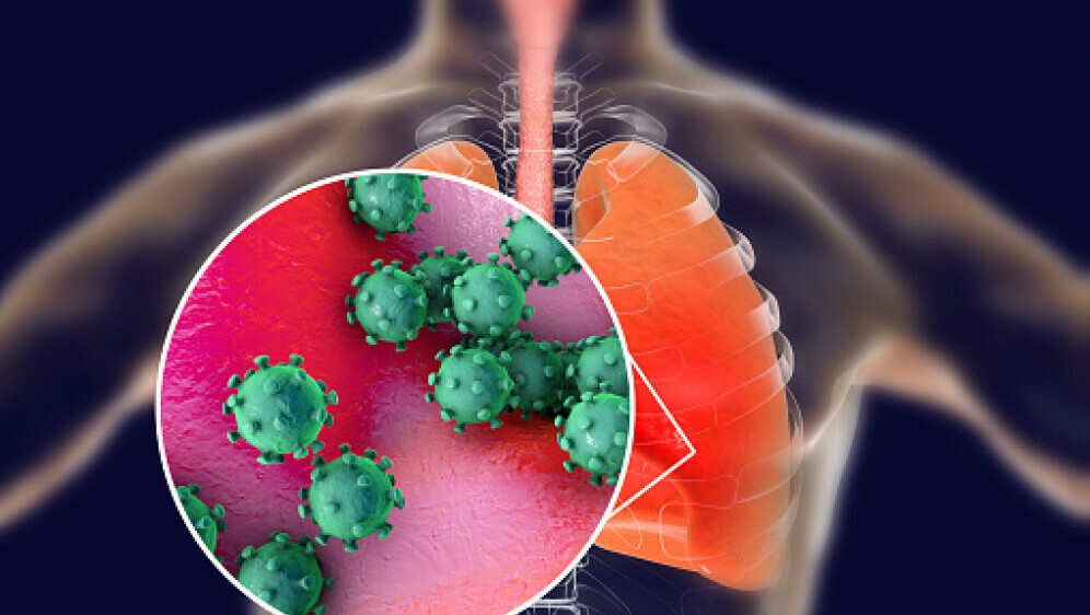 Virus A H3N2, ilustracija
