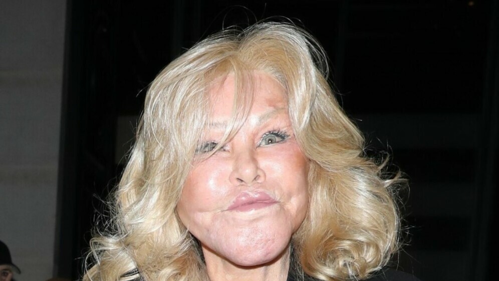 Jocelyn Wildenstein