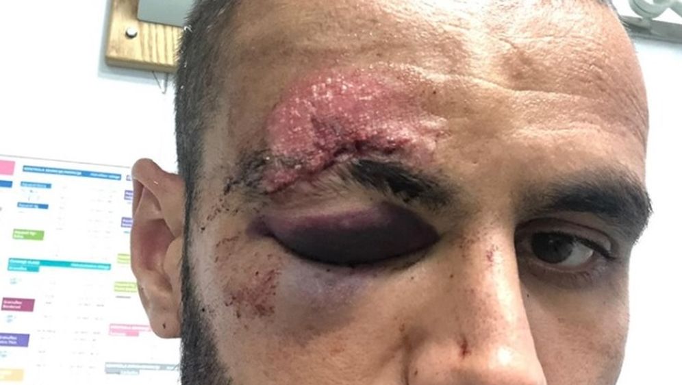 Muzafer Ejupi (Foto: NK Slaven Belupo)