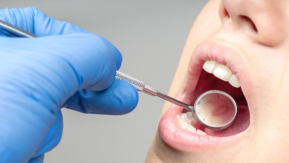 Pregled usne šupljine, ilustracija